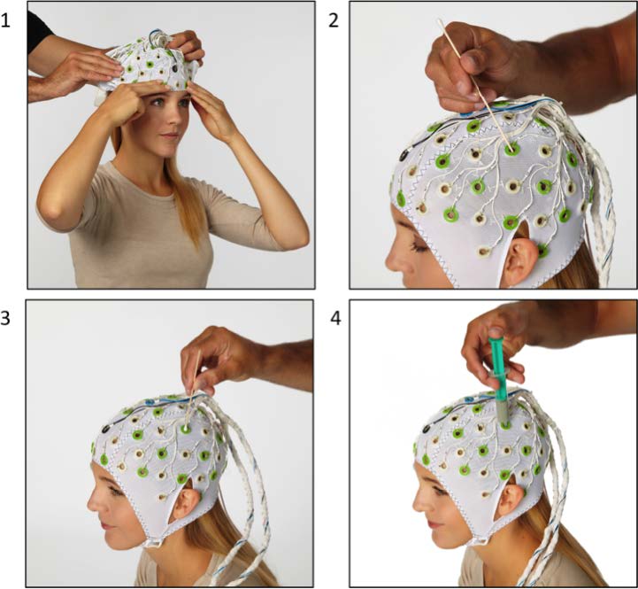 Positioning the ECG Electrode